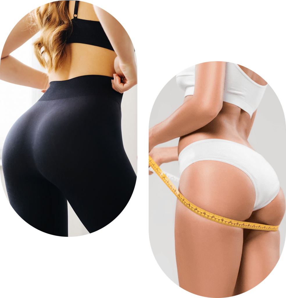 Augmentation des fesses