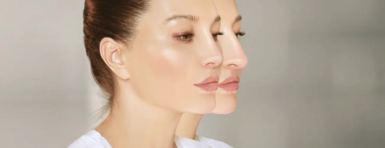 Rhinoplastie Tunisie